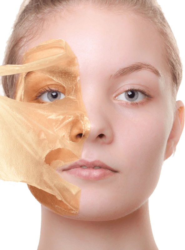Corrective Skin Peels & Collagen Induction